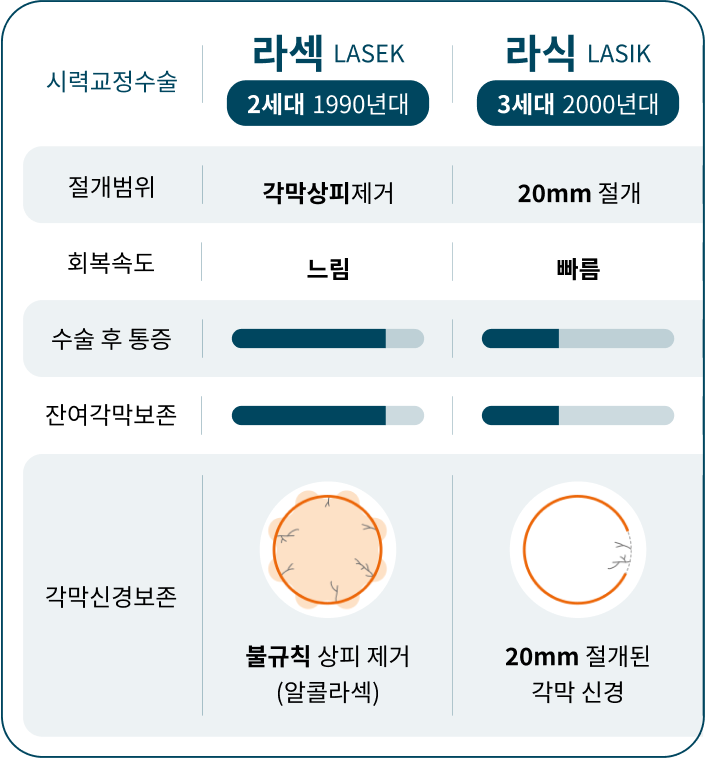 스마일 라식 특징